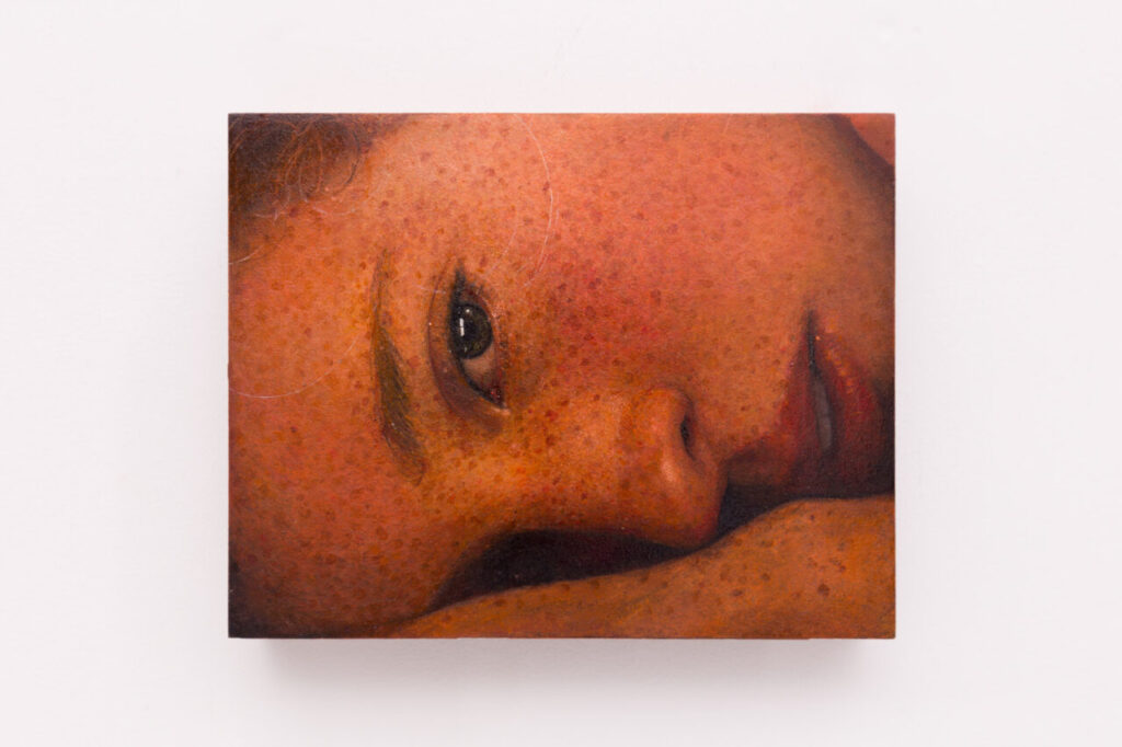 Retrato de una mujer con piel pecosa y mirada intensa